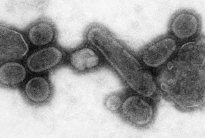Microscopic image of the reconstructed virus